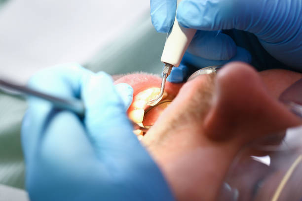 Best Emergency Tooth Extraction  in Pharr, TX
